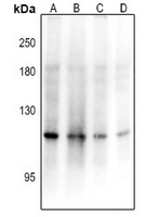 1 - Anti-ADAMTS17 Antibody AP61388