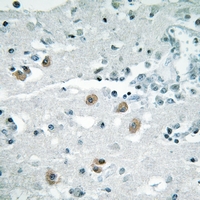 19 - Anti-PLA2G4D Antibody AP61389