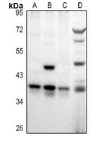 1 - Anti-RALY Antibody AP61390