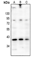 1 - Anti-OSR2 Antibody AP61392