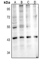 1 - Anti-IL-11RA Antibody AP61394
