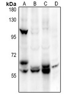 1 - Anti-ALPL Antibody AP61396
