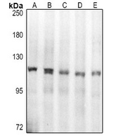 1 - Anti-Topoisomerase 1 Antibody AP61397