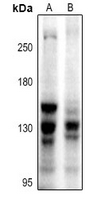 1 - Anti-BUB1 Antibody AP61398