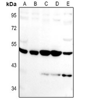 1 - Anti-VASH1 Antibody AP61401