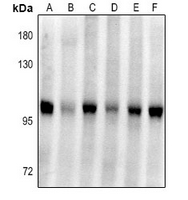 1 - Anti-Plasminogen Antibody AP61402