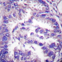 19 - Anti-Caspase 7 p20 Antibody AP61403