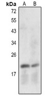 1 - Anti-Caspase 7 p20 Antibody AP61403