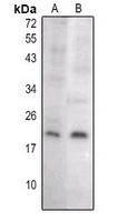 1 - Anti-Caspase 8 p18 Antibody [KO/KD Validated] AP61404