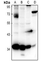1 - Anti-CD363 Antibody AP61405