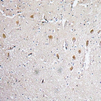 19 - Anti-FGF1 Antibody AP61406