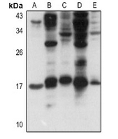 1 - Anti-FGF1 Antibody AP61406
