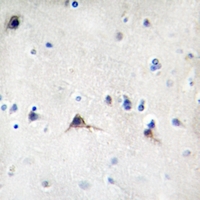 19 - Anti-Beta Amyloid Antibody AP61408
