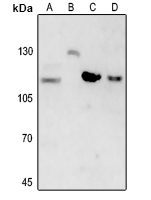 1 - Anti-Beta Amyloid Antibody AP61408