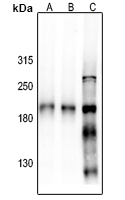 1 - Anti-NMDAR2B Antibody AP61409