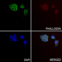 3 - Anti-Thrombospondin 4 Antibody AP61411