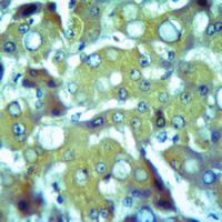 19 - Anti-Thrombospondin 4 Antibody AP61411