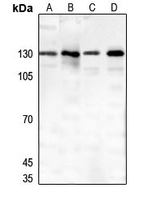 1 - Anti-Thrombospondin 4 Antibody AP61411