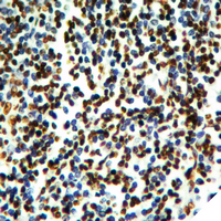 19 - Anti-Histone H2B (Acetyl-K20) Antibody AP61412