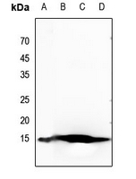 1 - Anti-Histone H2B (Acetyl-K20) Antibody AP61412