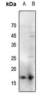 1 - Anti-Histone H3 (Acetyl-K56) Antibody AP61413
