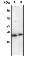 1 - Anti-Histone H3 (Acetyl-K79) Antibody AP61414