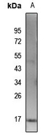 1 - Anti-Histone H3 (Acetyl-K115) Antibody AP61415