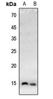 1 - Anti-Histone H4 (Acetyl-K20) Antibody AP61416