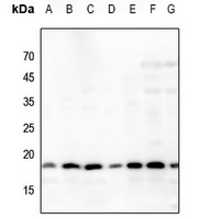 1 - Anti-Histone H3 (Acetyl-K64) Antibody AP61417