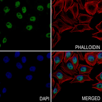 3 - Anti-Histone H2A (Butyryl-K5) Antibody AP61418