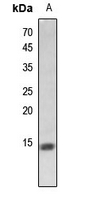 1 - Anti-Histone H2A (Butyryl-K5) Antibody AP61418