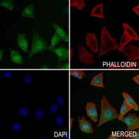 3 - Anti-Histone H2B (Butyryl-K5) Antibody AP61419
