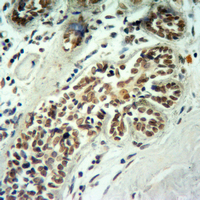 19 - Anti-Histone H2B (Butyryl-K5) Antibody AP61419