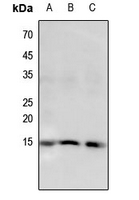 1 - Anti-Histone H2B (Butyryl-K5) Antibody AP61419