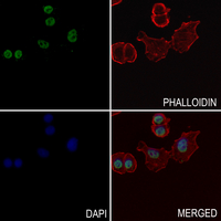 3 - Anti-Histone H2B (Butyryl-K15) Antibody AP61420