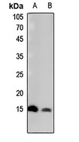 1 - Anti-Histone H2B (Butyryl-K15) Antibody AP61420
