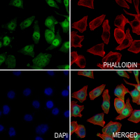 3 - Anti-Histone H2B (Butyryl-K20) Antibody AP61421