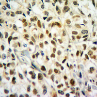 19 - Anti-Histone H2B (Butyryl-K20) Antibody AP61421