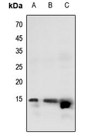 1 - Anti-Histone H2B (Butyryl-K20) Antibody AP61421
