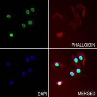 3 - Anti-Histone H2B (Butyryl-K23) Antibody AP61422