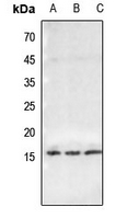 1 - Anti-Histone H2B (Butyryl-K23) Antibody AP61422