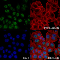 3 - Anti-Histone H3 (Butyryl-K18) Antibody AP61423