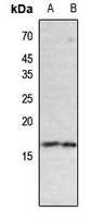 1 - Anti-Histone H3 (Butyryl-K18) Antibody AP61423