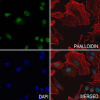 3 - Anti-Histone H3 (Butyryl-K23) Antibody AP61424
