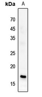 1 - Anti-Histone H3 (Butyryl-K23) Antibody AP61424