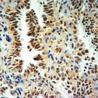 19 - Anti-Histone H3 (MonoMethyl-K9) Antibody AP61425