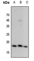 1 - Anti-Histone H3 (MonoMethyl-K9) Antibody AP61425