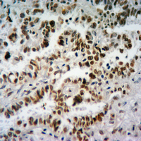 19 - Anti-Histone H3 (TriMethyl-K27) Antibody AP61426