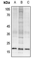 1 - Anti-Histone H3 (TriMethyl-K27) Antibody AP61426