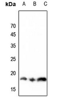 1 - Anti-Histone H3 (MonoMethyl-K36) Antibody AP61427